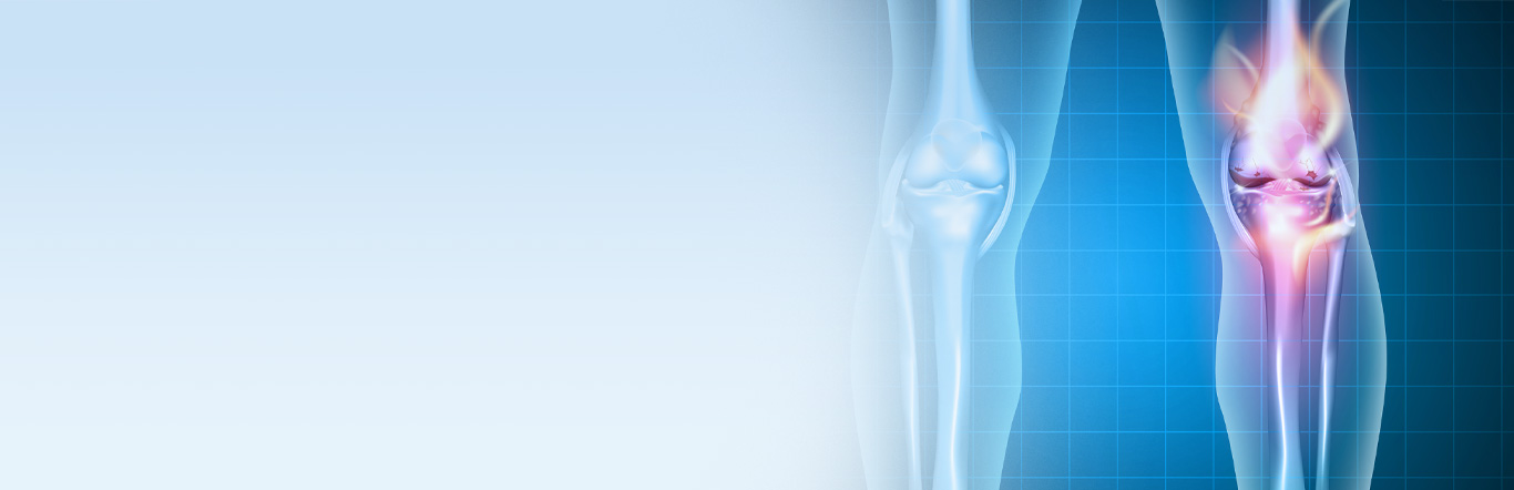 Illustration close up of knee x-ray.